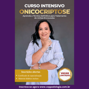 Curso Intensivo de Onicocriptose